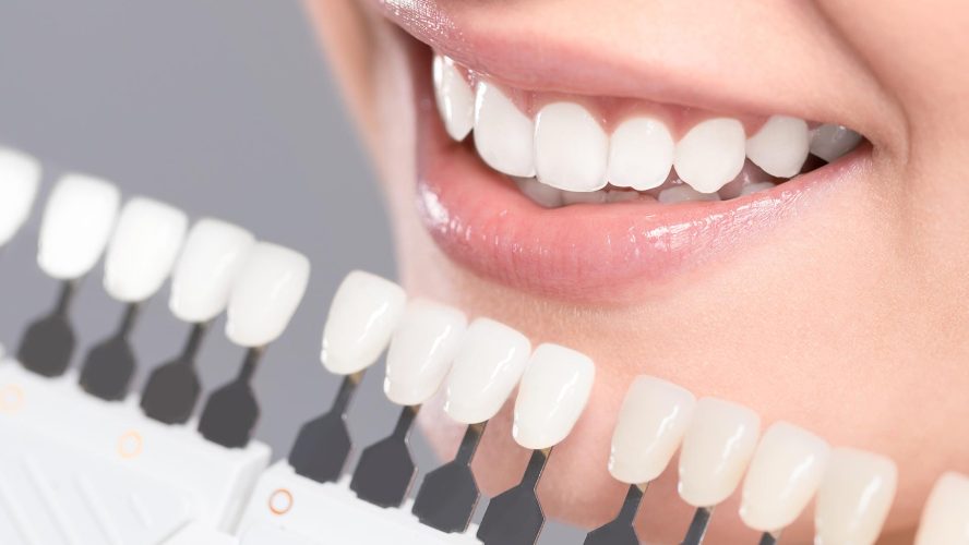 Cosmetic Dentistry – Benefits, And Importance of Using It!